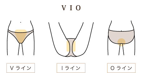 ＶＩＯ