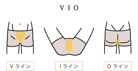 ＶＩＯ